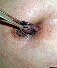 Belgian Needle BDSM