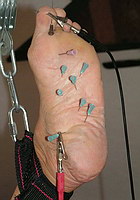 nåle og elektro tortur